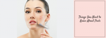 Everything you need to know about peels